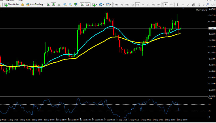 EUR USD technical analysis September 18, 2018